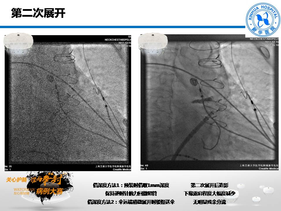 幻灯片10.JPG