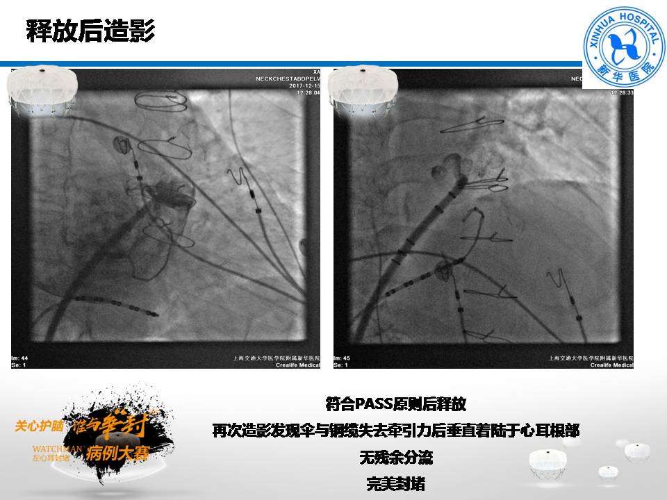 幻灯片13.JPG