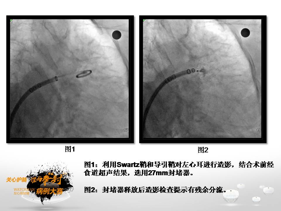 幻灯片9.JPG