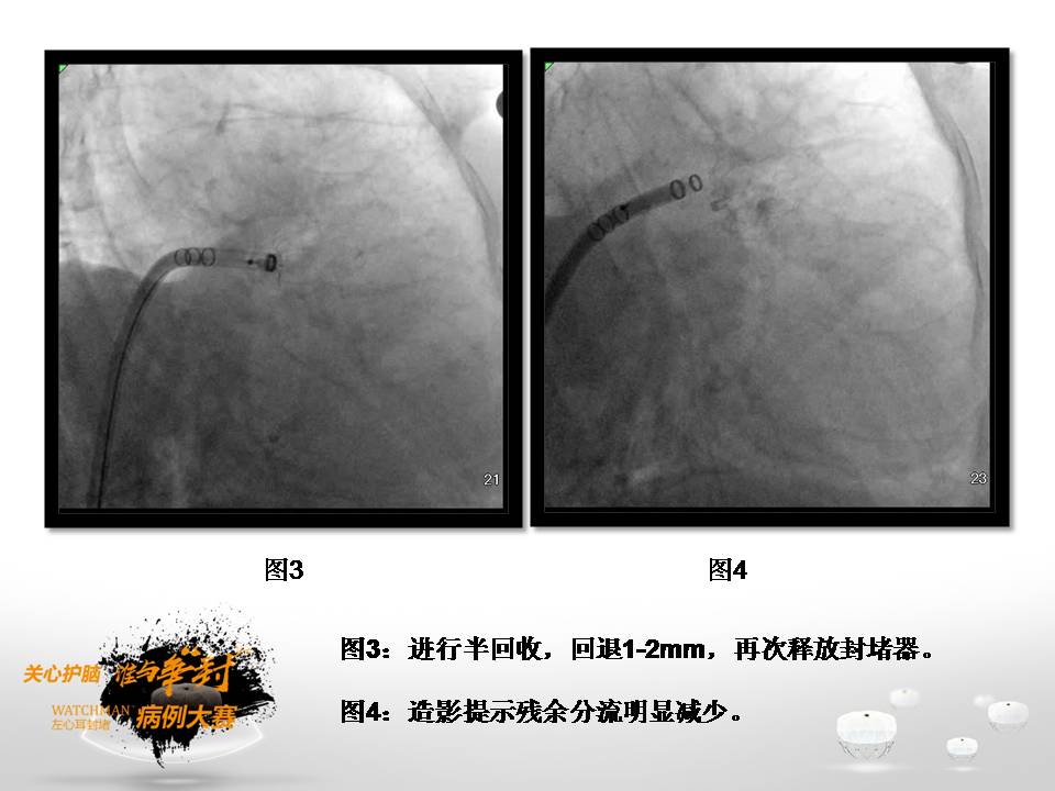 幻灯片10.JPG