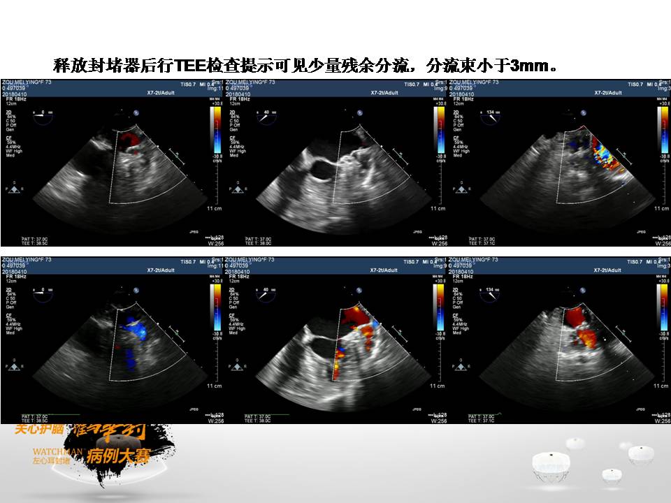 幻灯片12.JPG