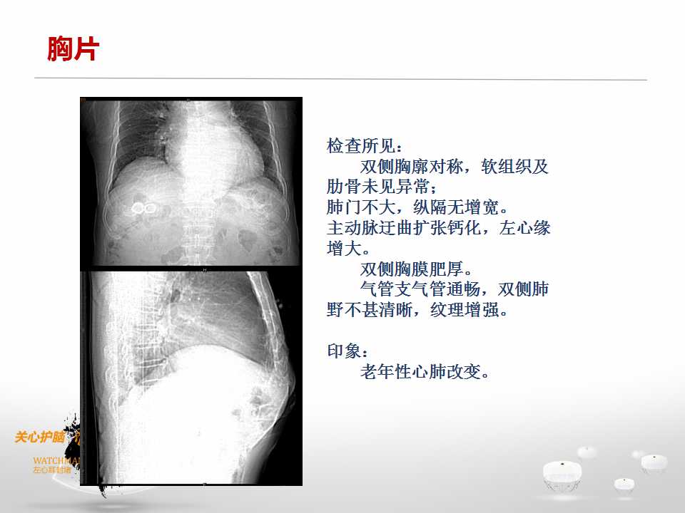 幻灯片6.jpg