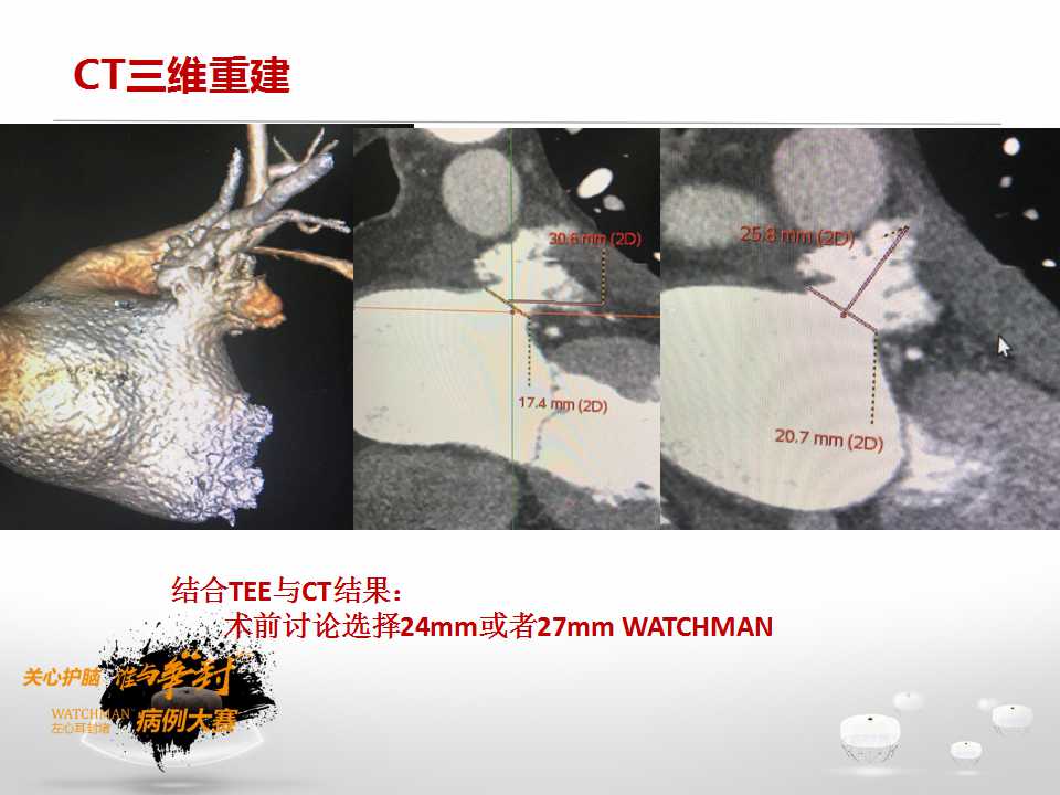 幻灯片9.jpg