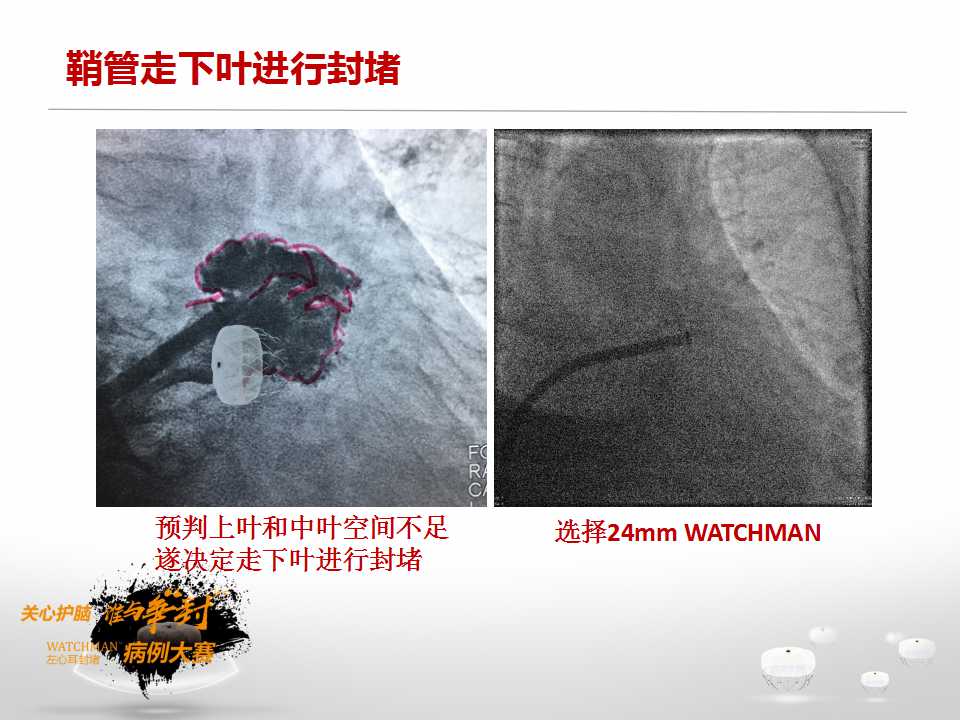 幻灯片12.jpg