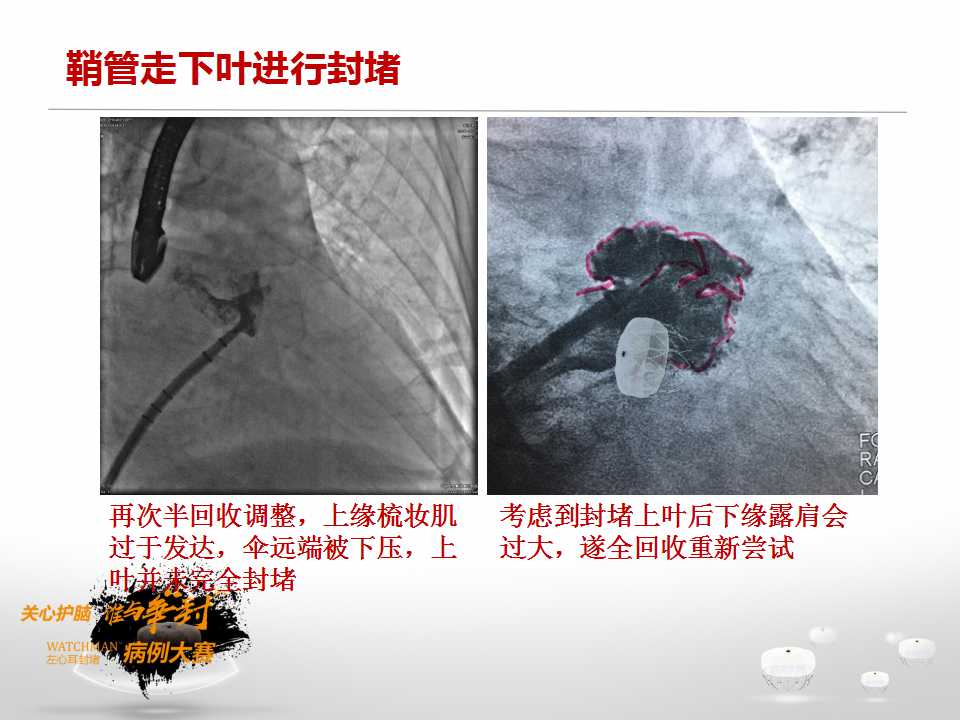 幻灯片14.jpg