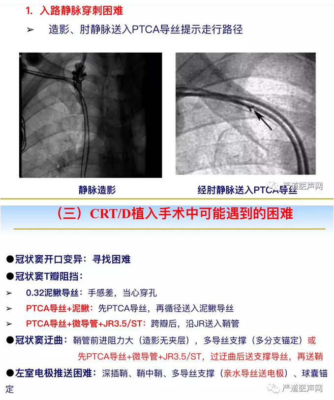 微信截图_20180827150108.png