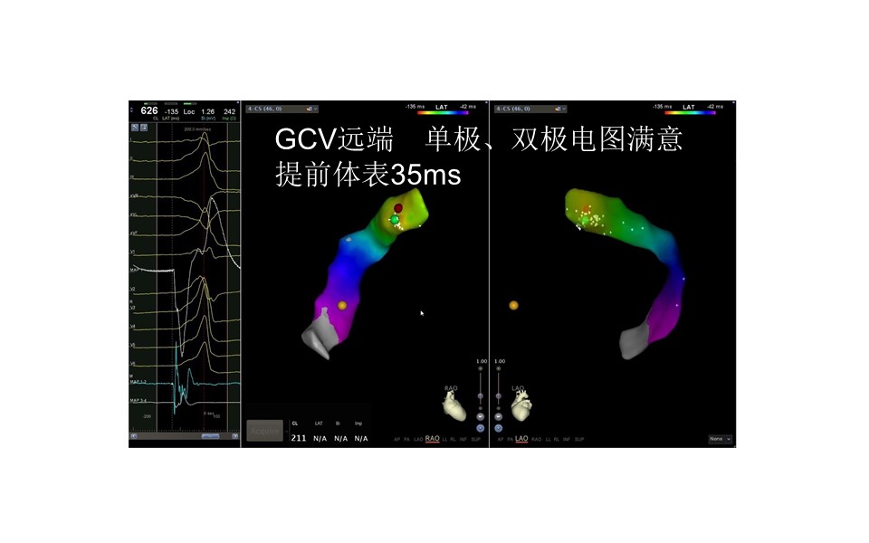 幻灯片11.JPG
