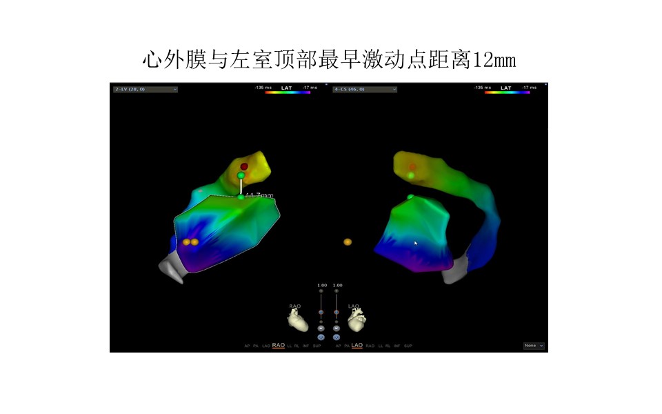 幻灯片15.JPG