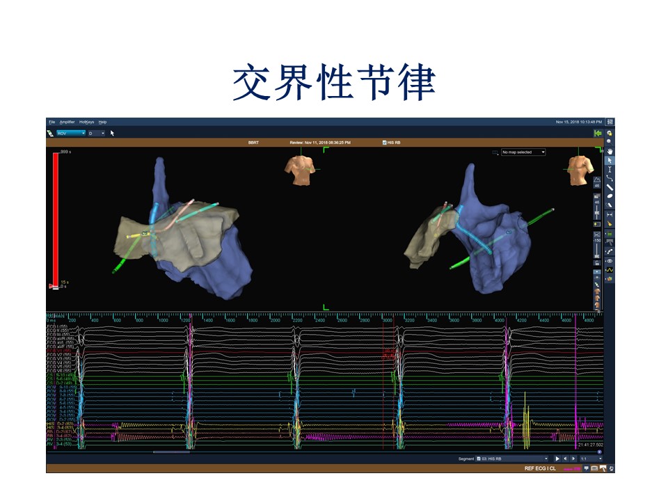 幻灯片18.JPG