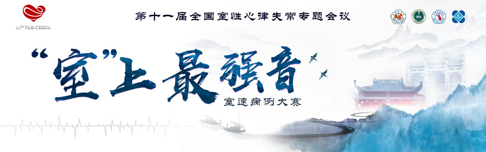 顶通-终_副本.jpg