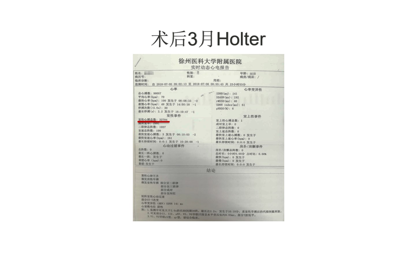 01李承宗-室性早搏消融一例.jpg