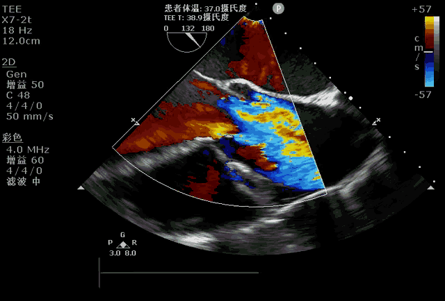 3.gif