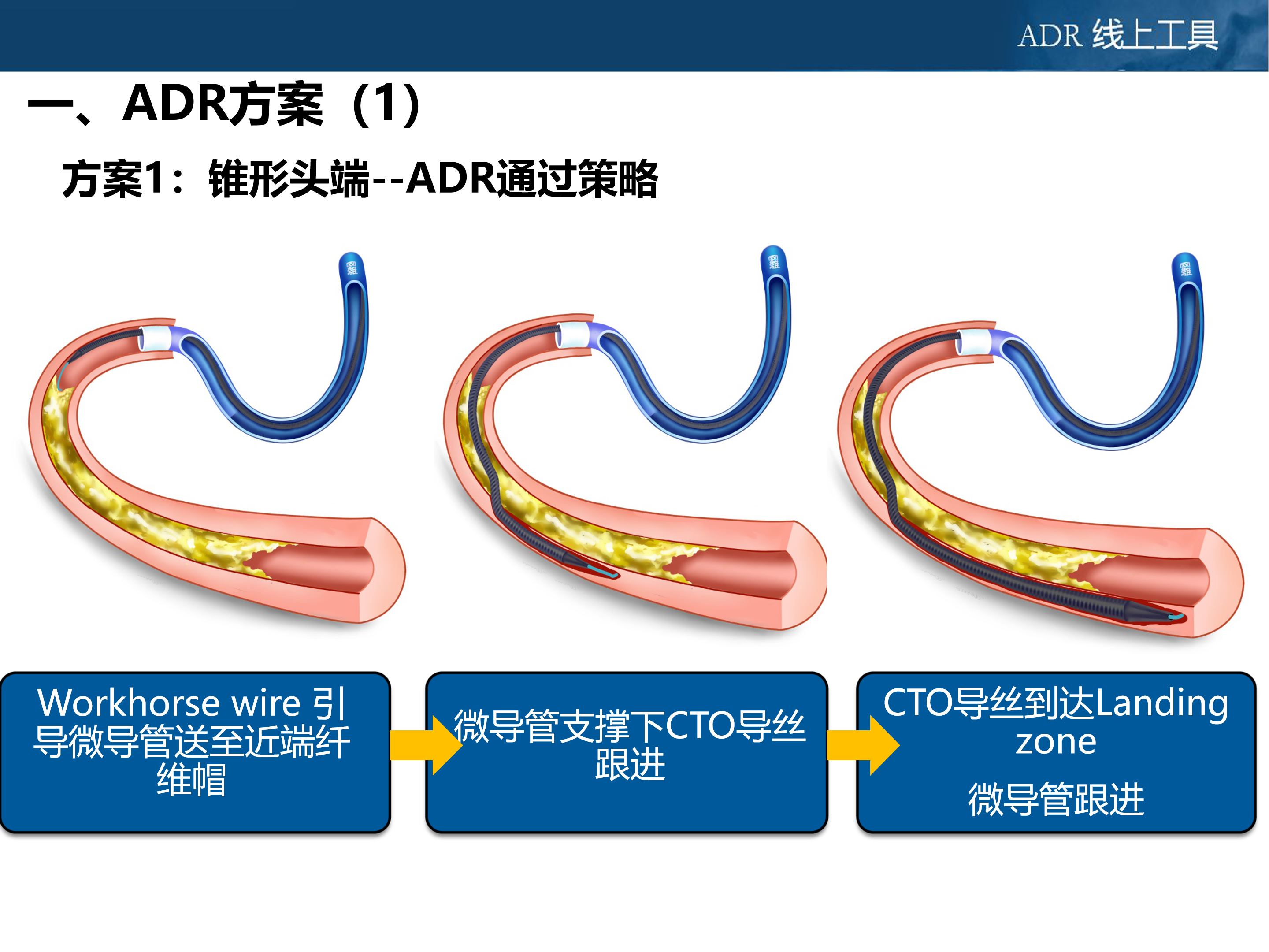 2.2 ADR操作流程-文字版-2019315_03.png