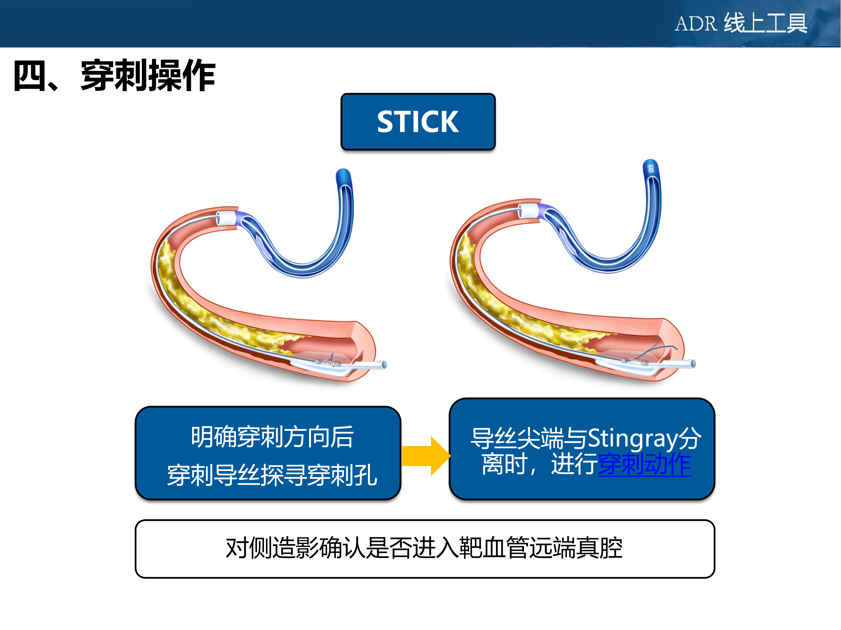 2.2 ADR操作流程-文字版-2019315_11.png