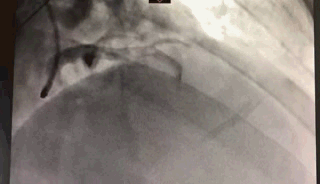 5.gif