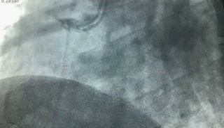 6.gif