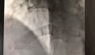 7.gif