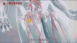 3~2.gif