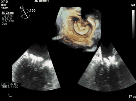 3.gif