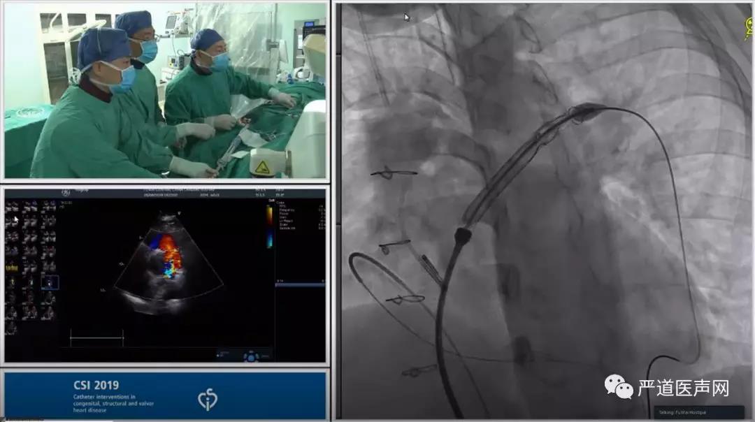左侧股静脉,股动脉,然后于左侧股静脉,股动脉分别植入5f猪尾导管至肺