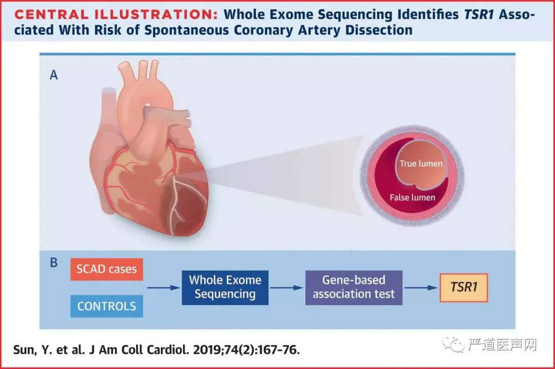 汪道文等JACC发文揭示自发性冠脉夹层的基因异常 -- 严道医声网