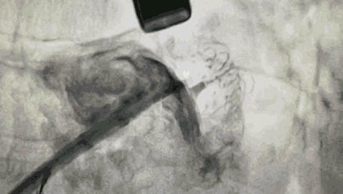 9.gif