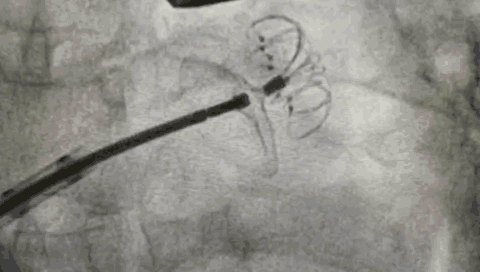 10.gif