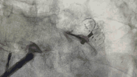 11.gif