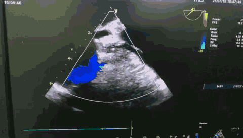 12.gif