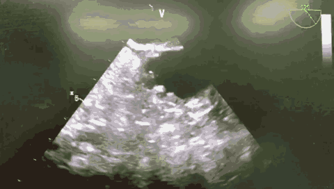 13.gif