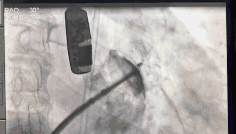 19.gif