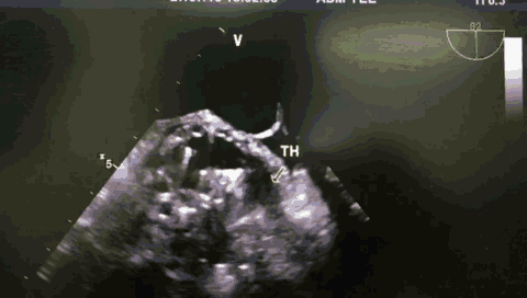 21.gif