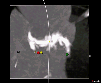 3.gif