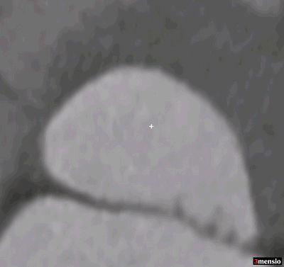 10.gif