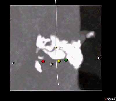11.gif