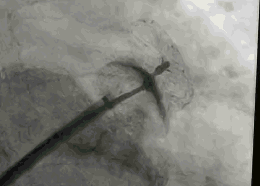 4.gif