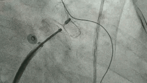 5.gif
