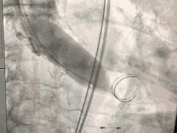 6.gif