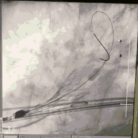 9.gif