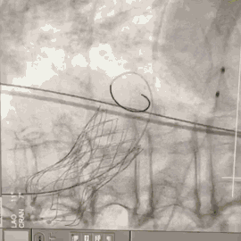 10.gif
