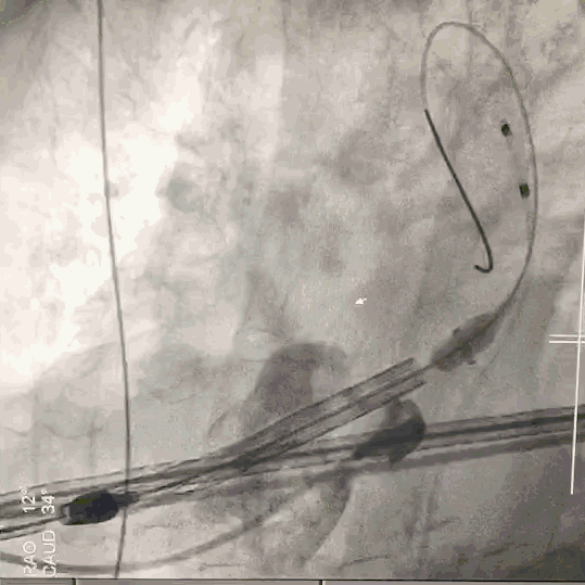 7.gif