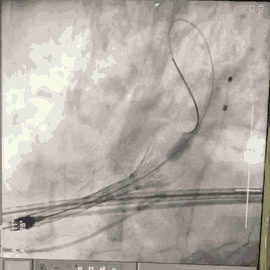 8.gif