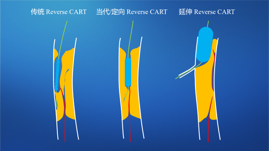 CTO WEEK丨杨峻青：双向贯通CTO的基本处方——Reverse CART演变与技术要点 严道医声网