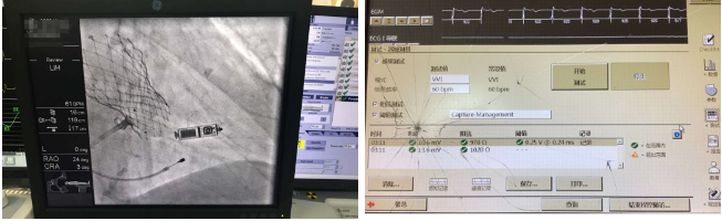 微信截图_20200607144659.png