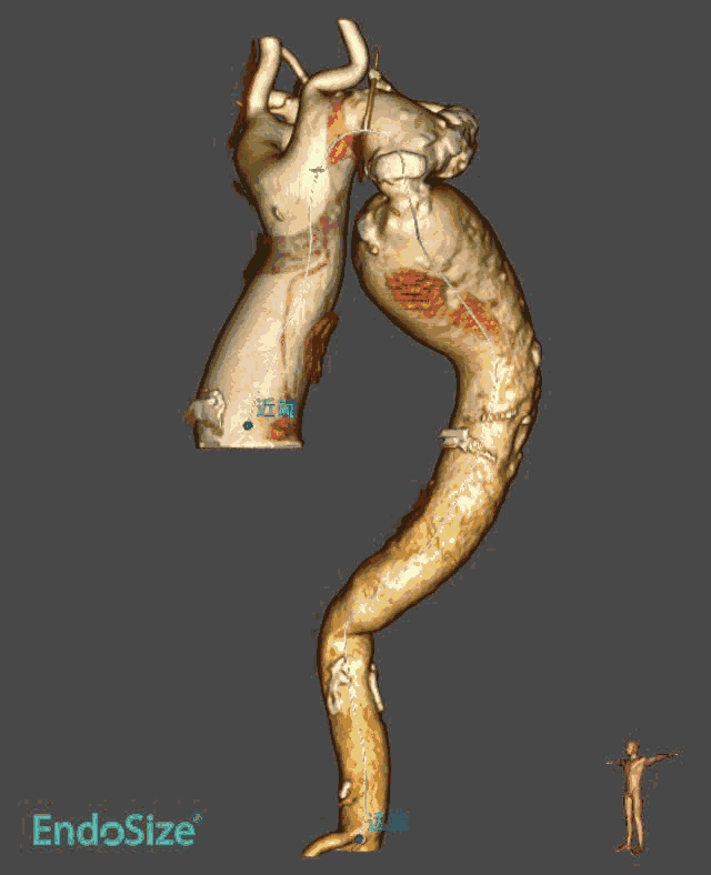 4.gif