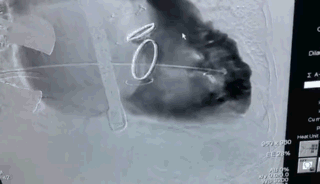 2.gif