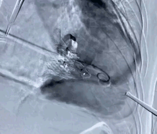 3.gif