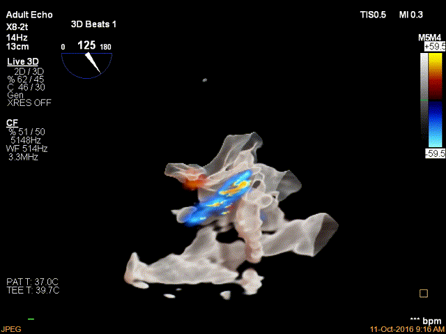 5.gif