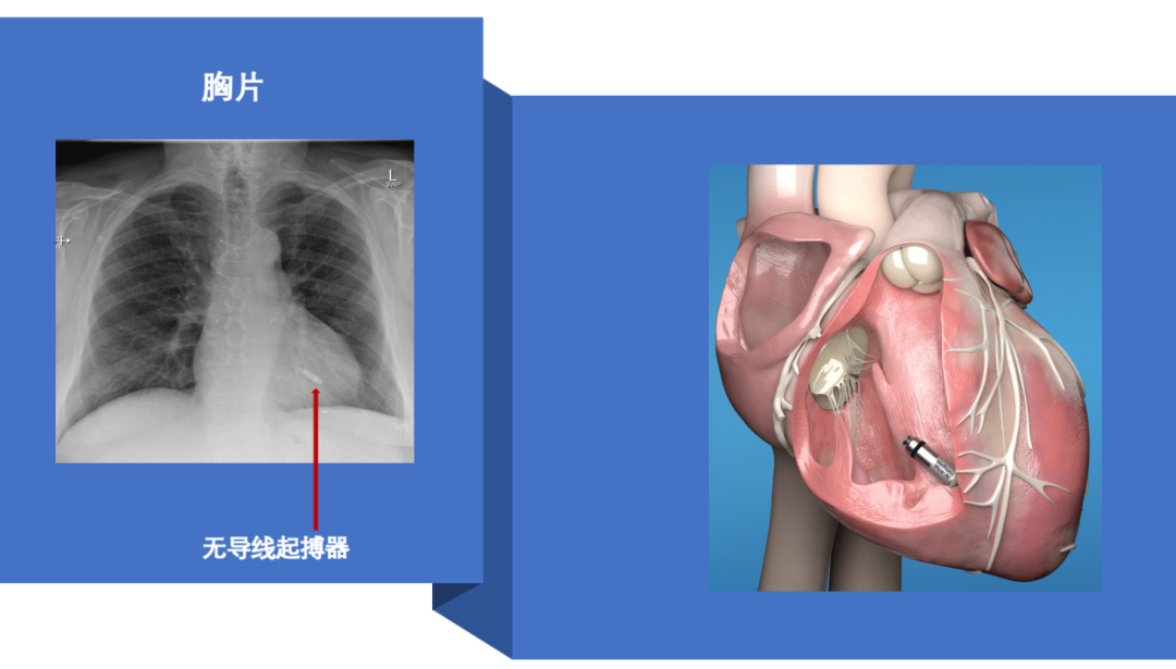 微信图片_20210205153232.png