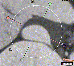image013 00_00_00-00_00_30.gif